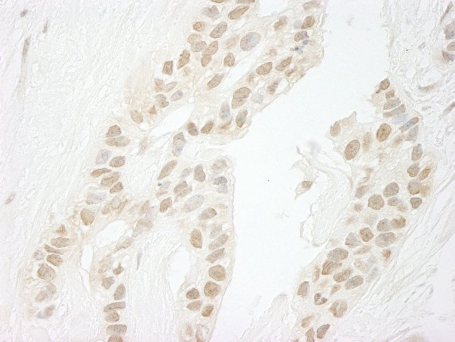 PPP1CC Antibody in Immunohistochemistry (Paraffin) (IHC (P))