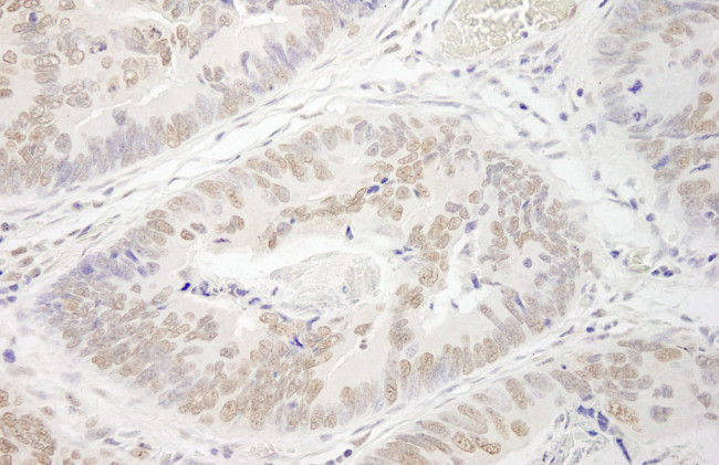 PRMT6 Antibody in Immunohistochemistry (Paraffin) (IHC (P))