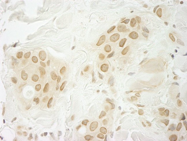MKRN1 Antibody in Immunohistochemistry (Paraffin) (IHC (P))