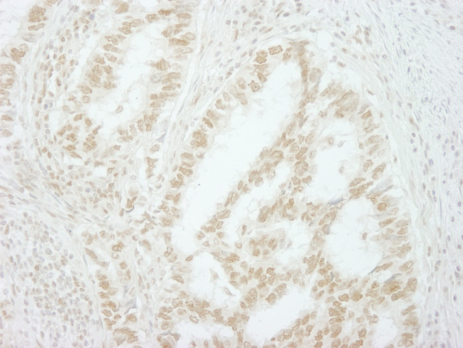 MKRN2 Antibody in Immunohistochemistry (Paraffin) (IHC (P))