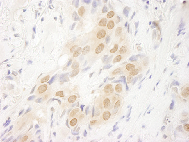 DOT1L Antibody in Immunohistochemistry (Paraffin) (IHC (P))