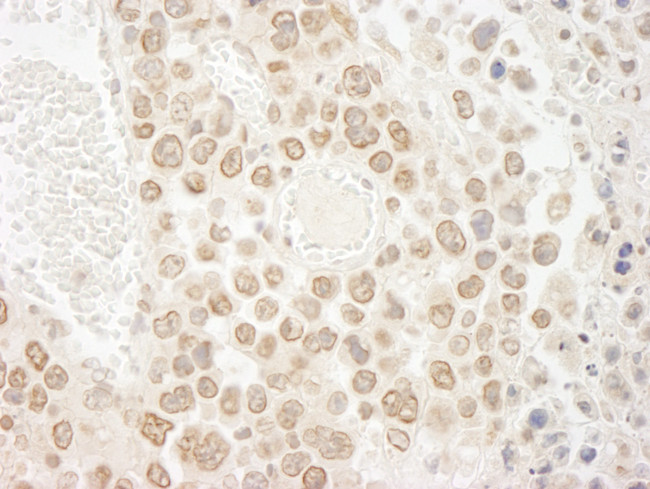 DTL/CDT2 Antibody in Immunohistochemistry (Paraffin) (IHC (P))