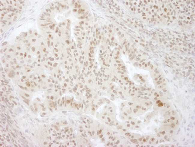 KIFC1 Antibody in Immunohistochemistry (Paraffin) (IHC (P))