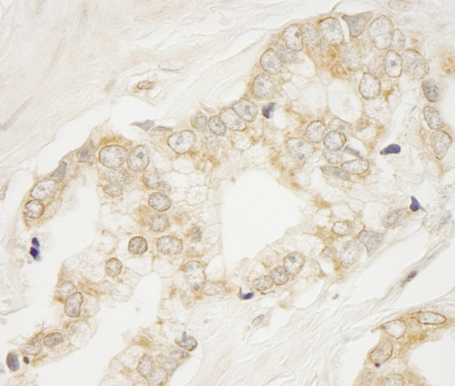 BIG1/ARFGEF1 Antibody in Immunohistochemistry (Paraffin) (IHC (P))