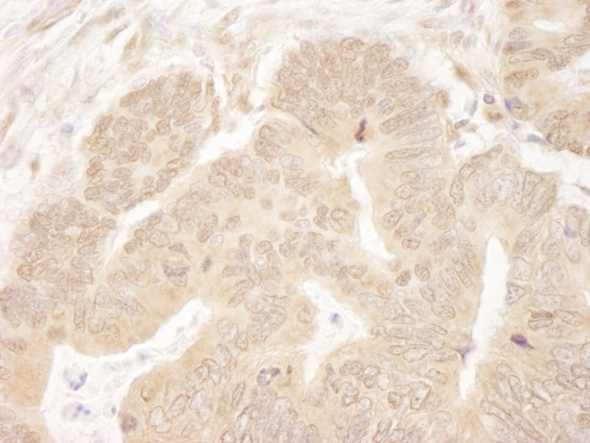 MCAK Antibody in Immunohistochemistry (Paraffin) (IHC (P))