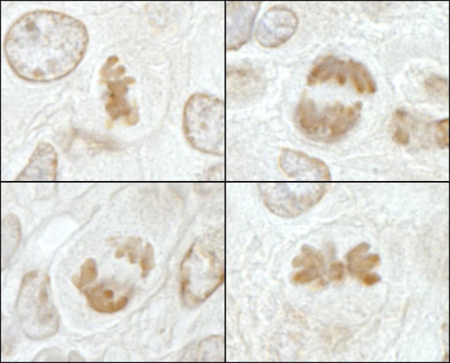MCAK Antibody in Immunohistochemistry (Paraffin) (IHC (P))
