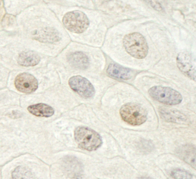 DHX33 Antibody in Immunohistochemistry (Paraffin) (IHC (P))