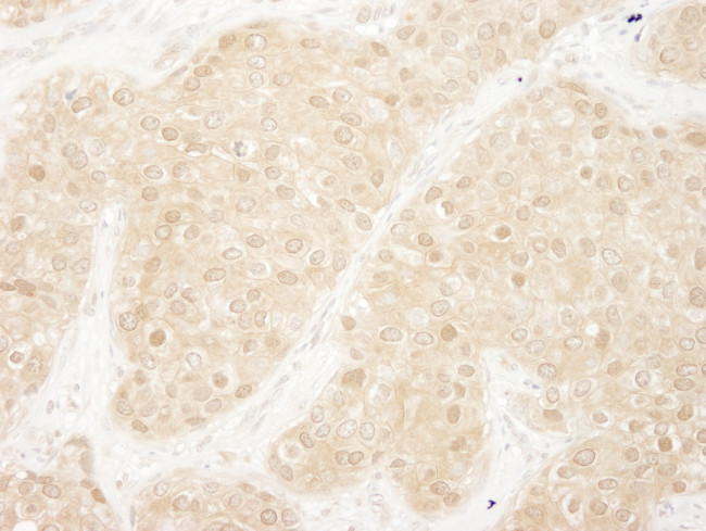 ERK1 Antibody in Immunohistochemistry (Paraffin) (IHC (P))