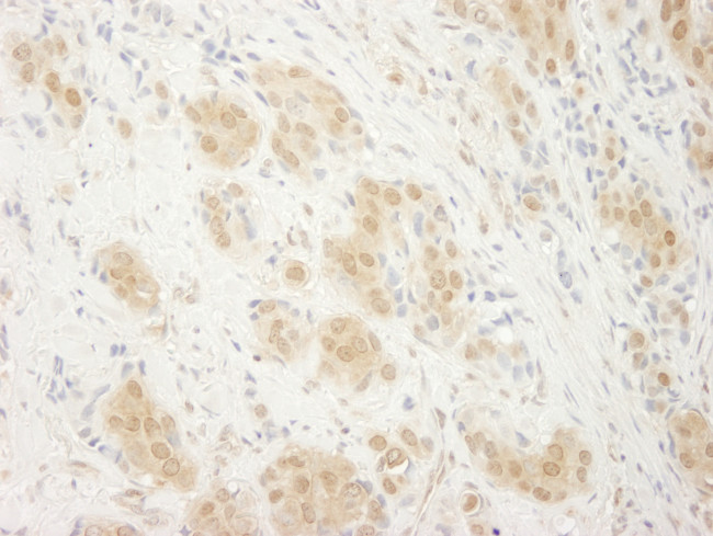 ERK2 Antibody in Immunohistochemistry (Paraffin) (IHC (P))