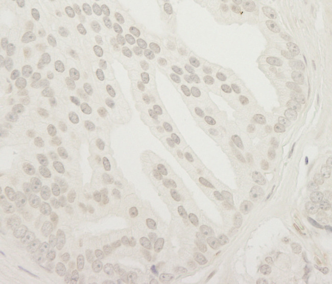 USP37 Antibody in Immunohistochemistry (Paraffin) (IHC (P))
