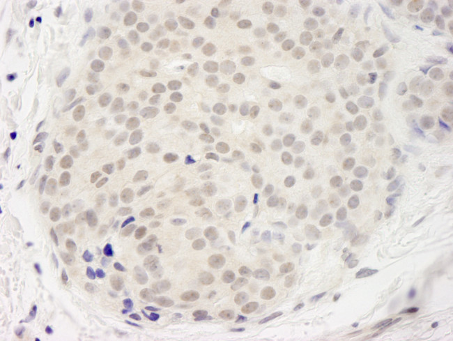 DDX23 Antibody in Immunohistochemistry (Paraffin) (IHC (P))