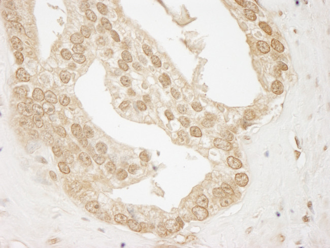 AKT1 Antibody in Immunohistochemistry (Paraffin) (IHC (P))