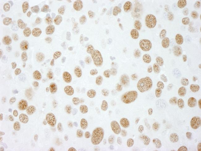 RALY Antibody in Immunohistochemistry (Paraffin) (IHC (P))