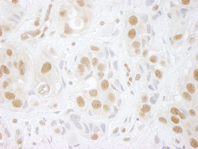 hPrp3p Antibody in Immunohistochemistry (Paraffin) (IHC (P))