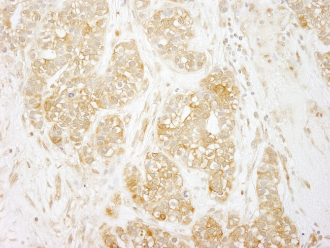 RelA Antibody in Immunohistochemistry (Paraffin) (IHC (P))