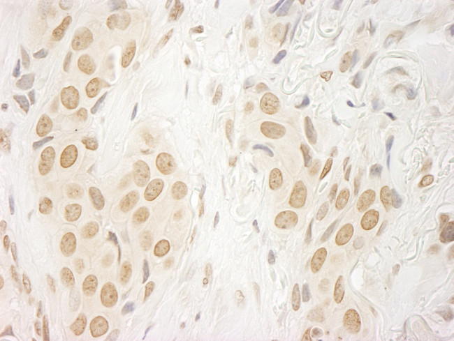 FALZ/BPTF Antibody in Immunohistochemistry (Paraffin) (IHC (P))