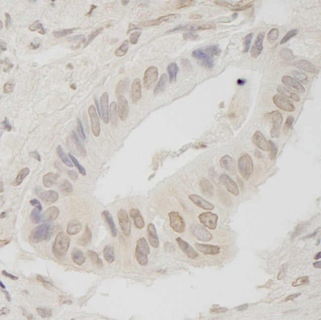 ANKRD28/PITK Antibody in Immunohistochemistry (Paraffin) (IHC (P))
