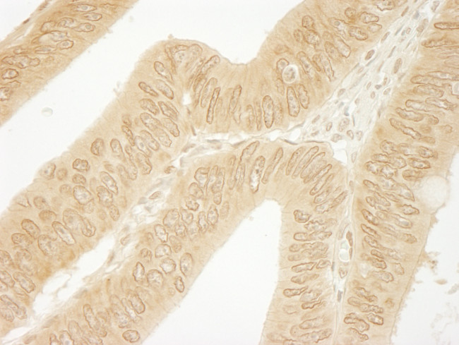 CTNND1 Antibody in Immunohistochemistry (Paraffin) (IHC (P))