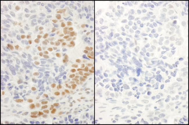 Phospho-RelA (Ser536) Antibody in Immunohistochemistry (Paraffin) (IHC (P))
