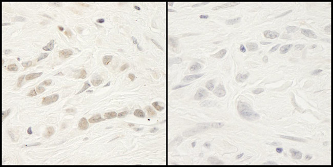 Phospho-RelA (Ser468) Antibody in Immunohistochemistry (Paraffin) (IHC (P))