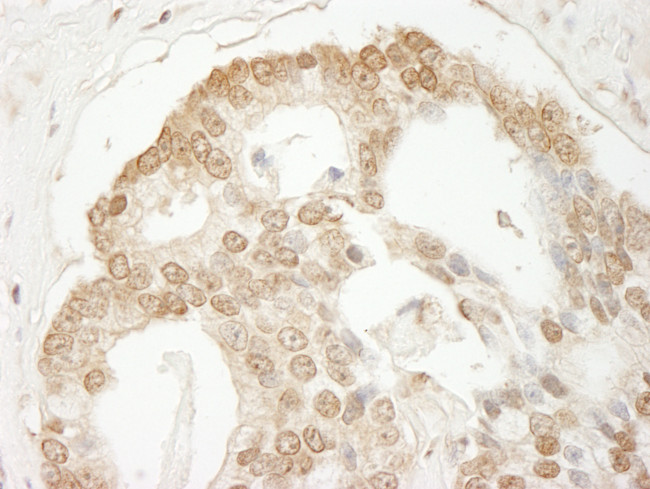 C1orf55 Antibody in Immunohistochemistry (Paraffin) (IHC (P))