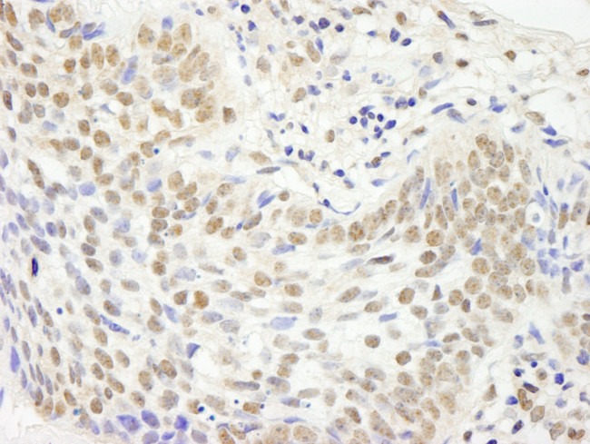 JHDM1A Antibody in Immunohistochemistry (Paraffin) (IHC (P))