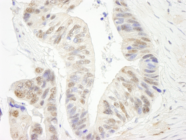 ERCC5/XPG Antibody in Immunohistochemistry (Paraffin) (IHC (P))