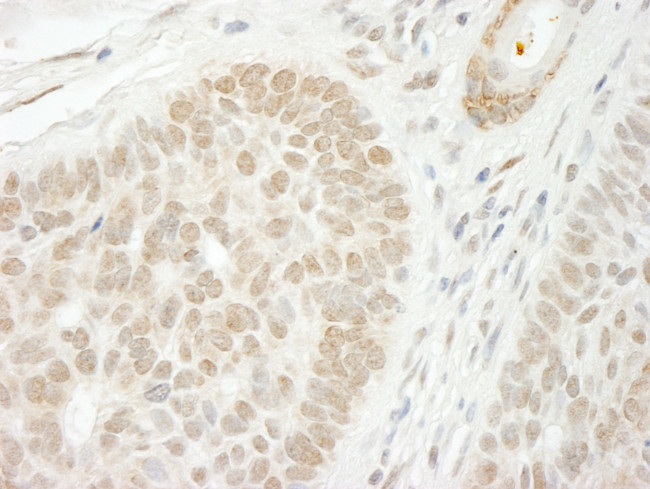 CSTF2T/TauCSTF64 Antibody in Immunohistochemistry (Paraffin) (IHC (P))