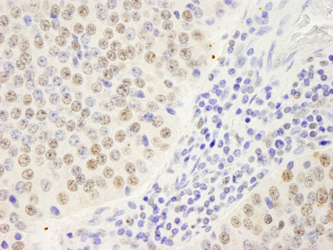 Symplekin Antibody in Immunohistochemistry (Paraffin) (IHC (P))
