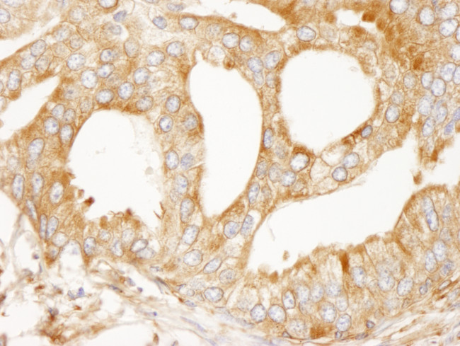 MAP4 Antibody in Immunohistochemistry (Paraffin) (IHC (P))
