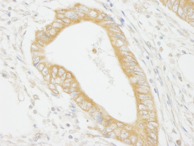 MAP4K4/HGK Antibody in Immunohistochemistry (Paraffin) (IHC (P))