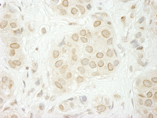 LAP1B Antibody in Immunohistochemistry (Paraffin) (IHC (P))