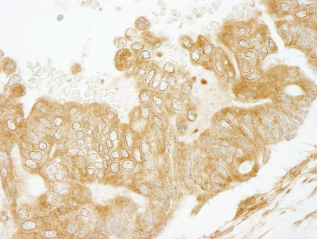 EEA1 Antibody in Immunohistochemistry (Paraffin) (IHC (P))