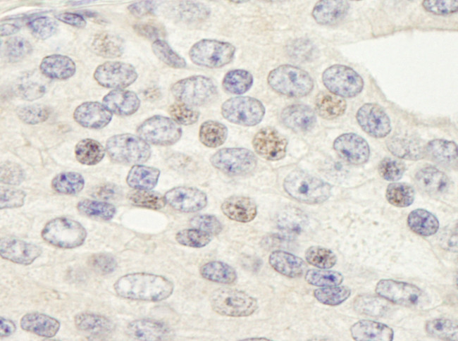 ZNF592 Antibody in Immunohistochemistry (Paraffin) (IHC (P))