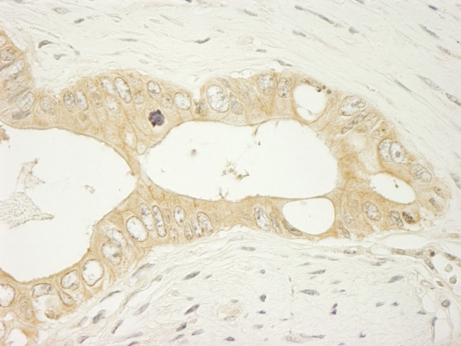 LARP1 Antibody in Immunohistochemistry (Paraffin) (IHC (P))