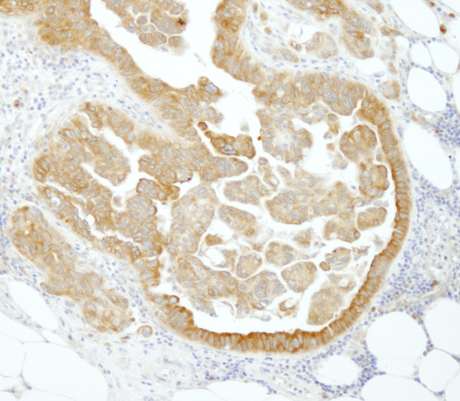 PABP4 Antibody in Immunohistochemistry (Paraffin) (IHC (P))