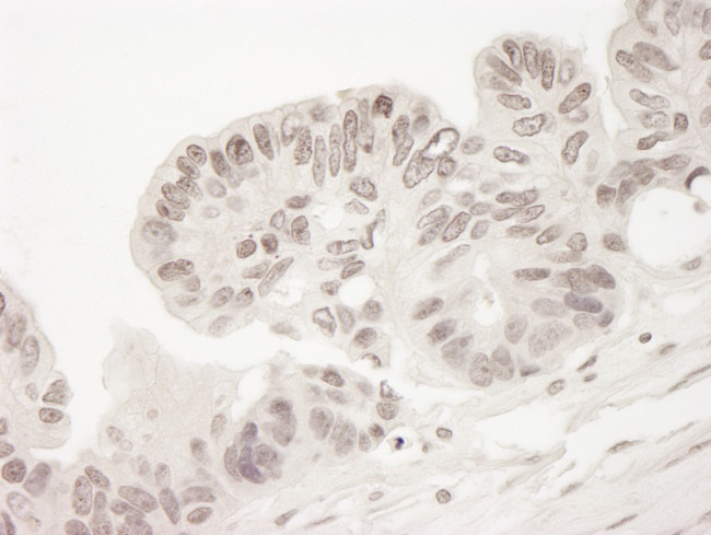 TORC2 Antibody in Immunohistochemistry (Paraffin) (IHC (P))