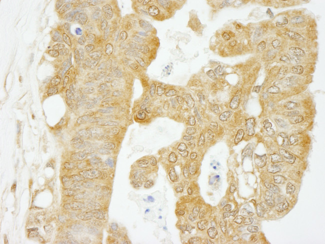 eIF4G1/eIF4GI Antibody in Immunohistochemistry (Paraffin) (IHC (P))
