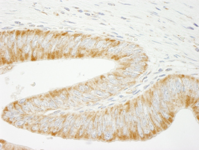 INPPL1/SHIP2 Antibody in Immunohistochemistry (Paraffin) (IHC (P))
