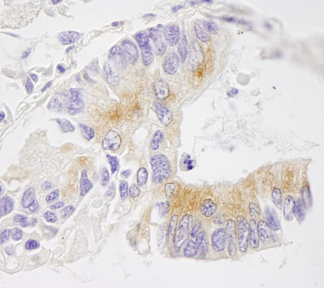 EML4 Antibody in Immunohistochemistry (Paraffin) (IHC (P))