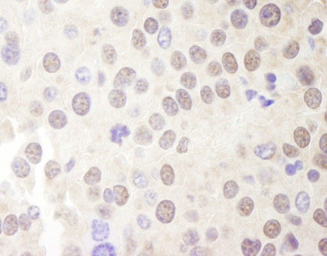 Menin Antibody in Immunohistochemistry (Paraffin) (IHC (P))