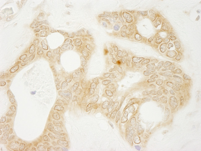 vPARP Antibody in Immunohistochemistry (Paraffin) (IHC (P))