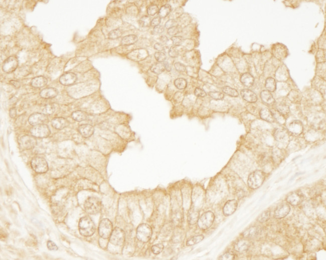 PDZ-RhoGEF Antibody in Immunohistochemistry (Paraffin) (IHC (P))