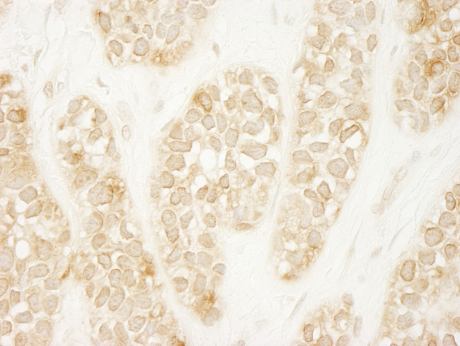 ARHGEF16 Antibody in Immunohistochemistry (Paraffin) (IHC (P))