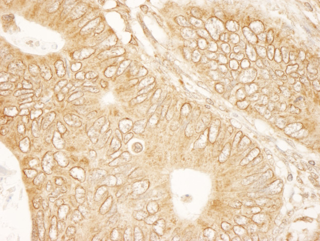 RanGAP1 Antibody in Immunohistochemistry (Paraffin) (IHC (P))