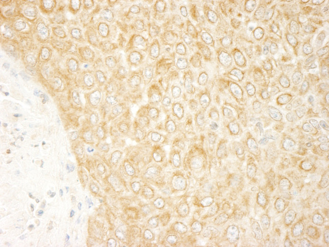 ZAK Antibody in Immunohistochemistry (Paraffin) (IHC (P))