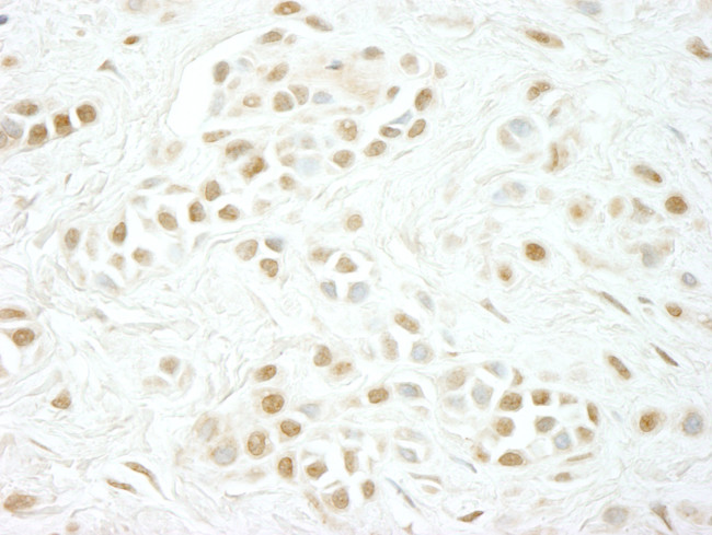 Cyclin C Antibody in Immunohistochemistry (Paraffin) (IHC (P))