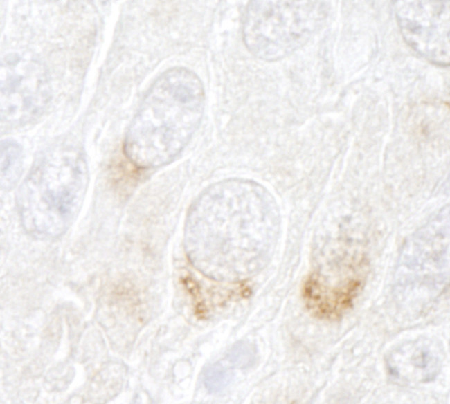 GBF1 Antibody in Immunohistochemistry (Paraffin) (IHC (P))