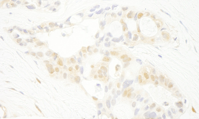 PRPF4B Antibody in Immunohistochemistry (Paraffin) (IHC (P))