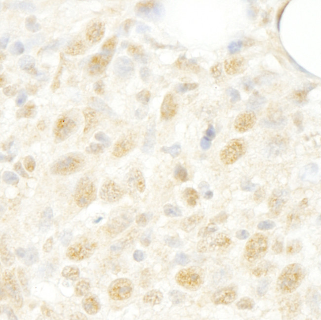 CROP/Luc7A Antibody in Immunohistochemistry (Paraffin) (IHC (P))